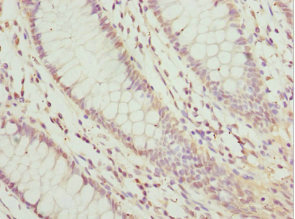 Immunohistochemistry (Formalin/PFA-fixed paraffin-embedded sections) - Anti-LEFTY2 antibody (AB229668), expandable thumbnail