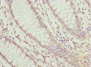 Immunohistochemistry (Formalin/PFA-fixed paraffin-embedded sections) - Anti-LEFTY2 antibody (AB229668)