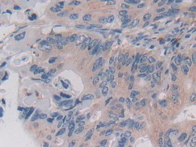 Immunohistochemistry (Formalin/PFA-fixed paraffin-embedded sections) - Anti-Legumain antibody (AB232870)