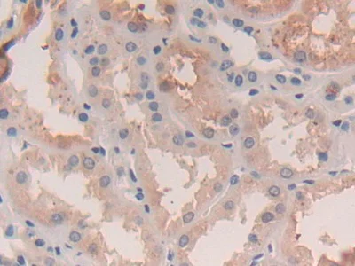 Immunohistochemistry (Formalin/PFA-fixed paraffin-embedded sections) - Anti-Legumain antibody (AB232870)