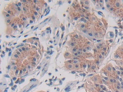 Immunohistochemistry (Formalin/PFA-fixed paraffin-embedded sections) - Anti-Legumain antibody (AB232870)