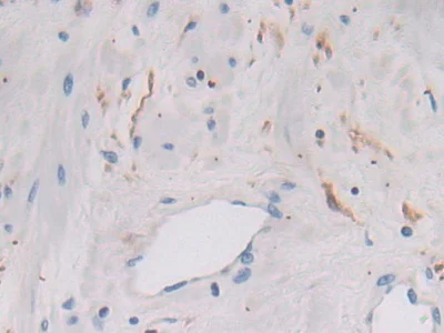 Immunohistochemistry (Formalin/PFA-fixed paraffin-embedded sections) - Anti-Legumain antibody (AB232870)