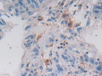 Immunohistochemistry (Formalin/PFA-fixed paraffin-embedded sections) - Anti-Legumain antibody (AB232870)