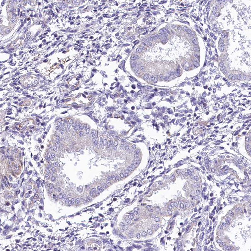 Immunohistochemistry (Formalin/PFA-fixed paraffin-embedded sections) - Anti-Leiomodin-3 antibody (AB122305)