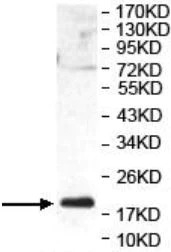 Western blot - Anti-LEMD1 antibody (AB201206)