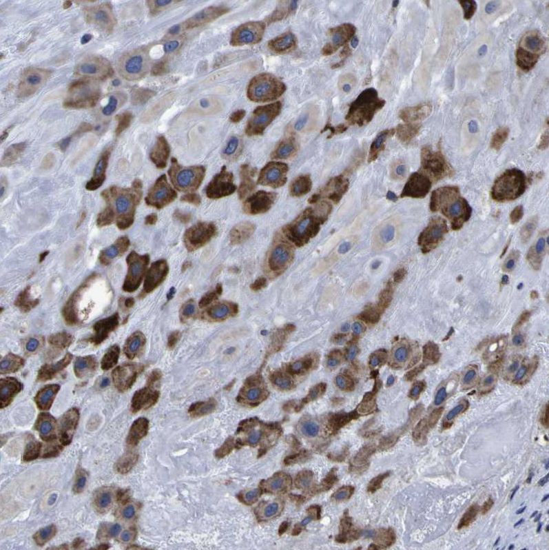 Immunohistochemistry (Formalin/PFA-fixed paraffin-embedded sections) - Anti-LEPRE1/P3H1 antibody (AB244326), expandable thumbnail
