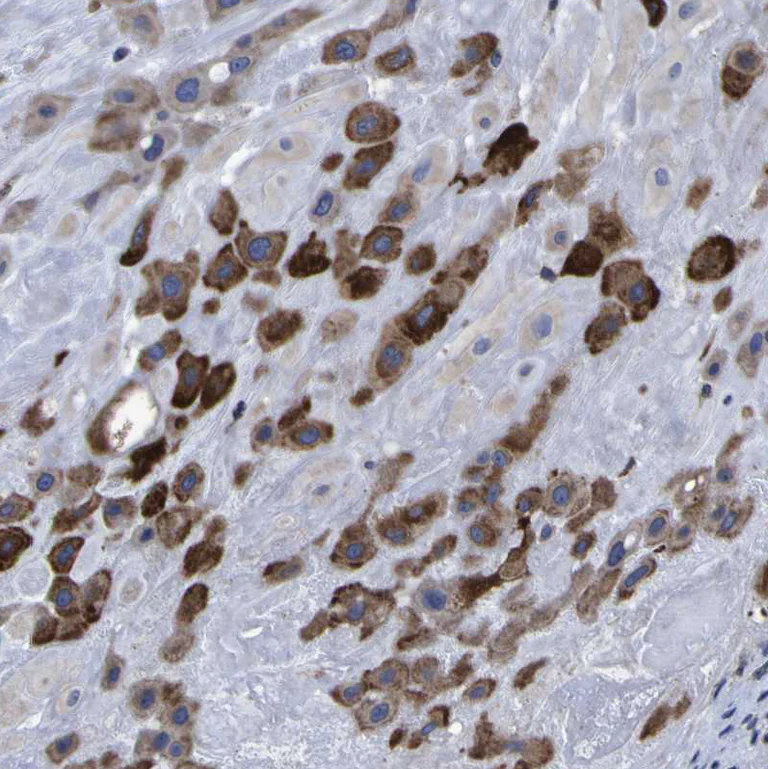 Immunohistochemistry (Formalin/PFA-fixed paraffin-embedded sections) - Anti-LEPRE1/P3H1 antibody (AB244326)