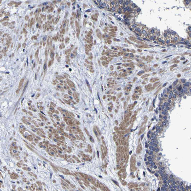 Immunohistochemistry (Formalin/PFA-fixed paraffin-embedded sections) - Anti-LEPRE1/P3H1 antibody (AB244326), expandable thumbnail