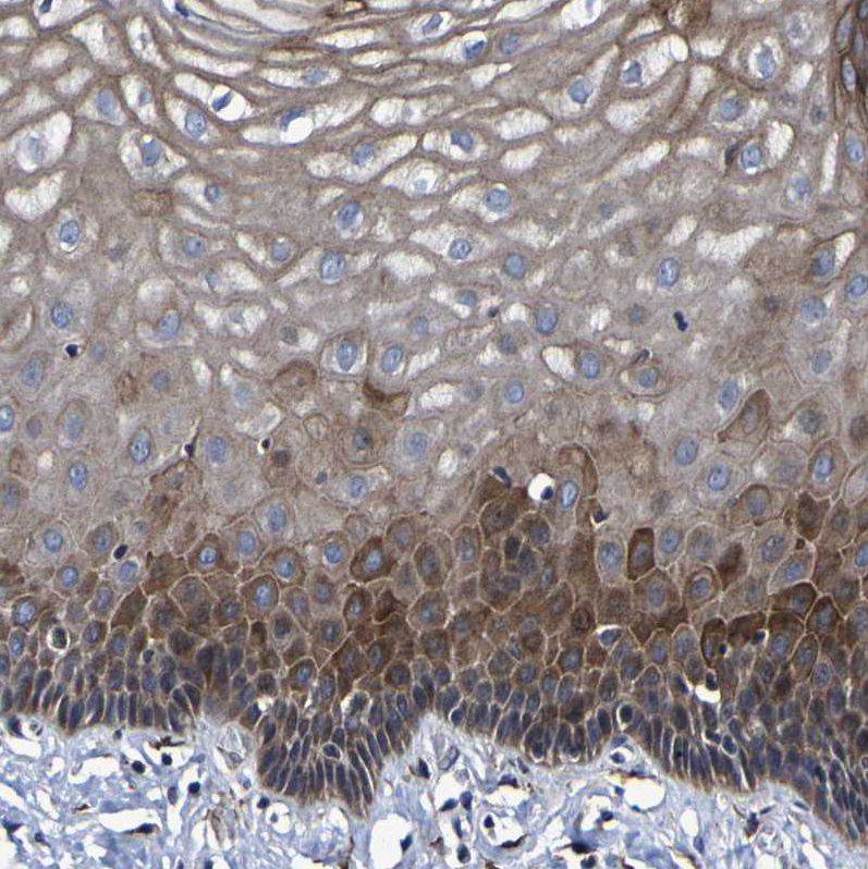 Immunohistochemistry (Formalin/PFA-fixed paraffin-embedded sections) - Anti-LEPRE1/P3H1 antibody (AB244326), expandable thumbnail