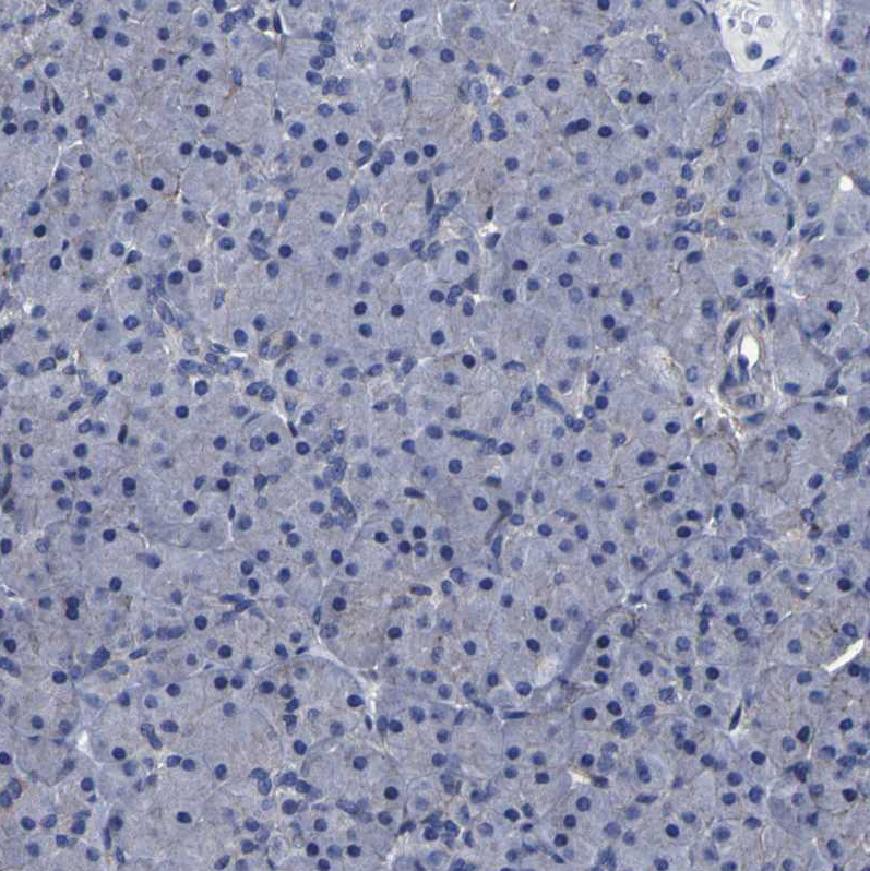 Immunohistochemistry (Formalin/PFA-fixed paraffin-embedded sections) - Anti-LEPRE1/P3H1 antibody (ab244326), expandable thumbnail