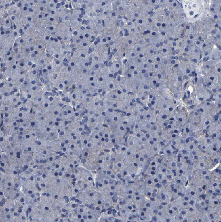 Immunohistochemistry (Formalin/PFA-fixed paraffin-embedded sections) - Anti-LEPRE1/P3H1 antibody (AB244326)