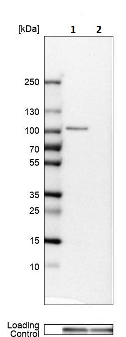 Western blot - Anti-LEPRE1/P3H1 antibody (AB244326), expandable thumbnail