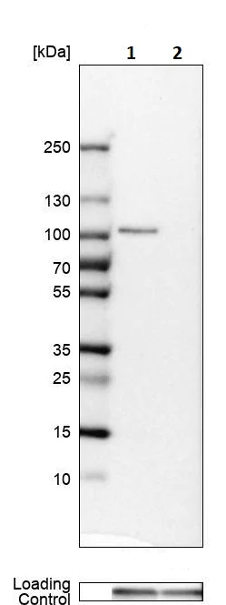 Western blot - Anti-LEPRE1/P3H1 antibody (AB244326)
