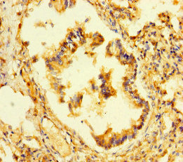 Immunohistochemistry (Formalin/PFA-fixed paraffin-embedded sections) - Anti-LEPREL1 antibody (AB222823), expandable thumbnail