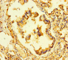 Immunohistochemistry (Formalin/PFA-fixed paraffin-embedded sections) - Anti-LEPREL1 antibody (AB222823)