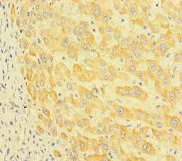 Immunohistochemistry (Formalin/PFA-fixed paraffin-embedded sections) - Anti-LEPREL1 antibody (AB222823)