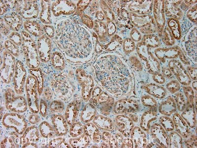 Immunohistochemistry (Formalin/PFA-fixed paraffin-embedded sections) - Anti-Leptin Receptor antibody (AB104403)