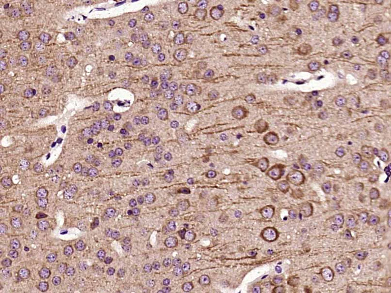 Immunohistochemistry (Formalin/PFA-fixed paraffin-embedded sections) - Anti-Leptin Receptor antibody (AB216690)