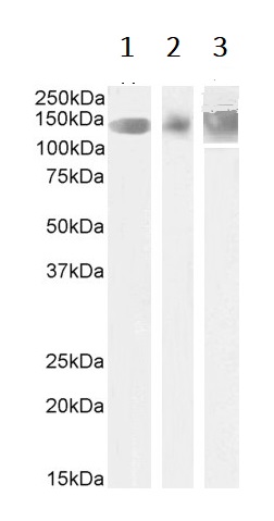 Western blot - Anti-Leptin Receptor antibody (AB50424), expandable thumbnail