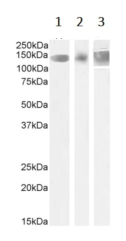 Western blot - Anti-Leptin Receptor antibody (AB50424)