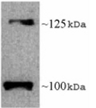 Western blot - Anti-Leptin Receptor antibody (AB5593), expandable thumbnail