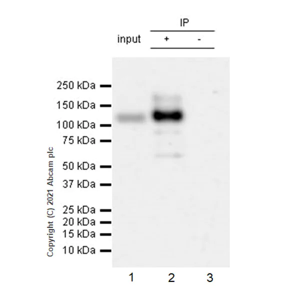 Immunoprecipitation - Anti-Leptin Receptor antibody [EPR23802-65] - BSA and Azide free (AB282595)