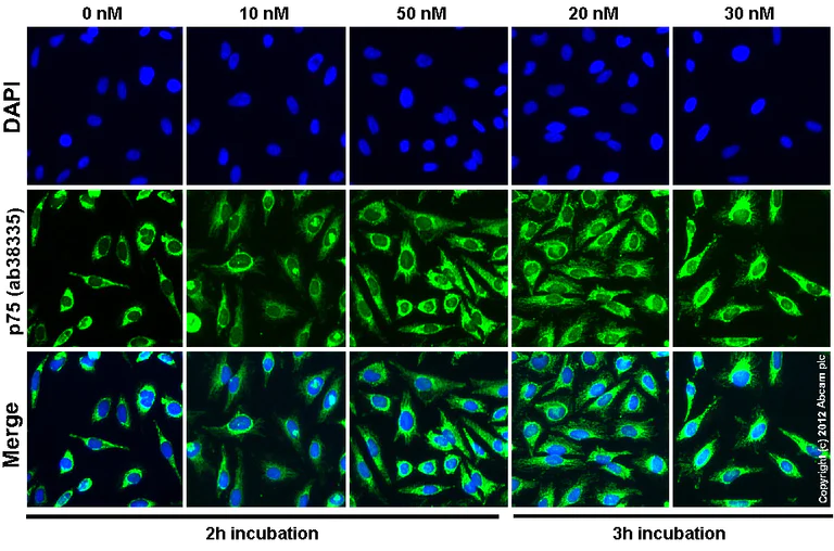Functional Studies - Leptomycin B (ethanol solution), Antibiotic, antifungal. Inhibitor of CRM-1 mediated nuclear export. (AB120501)