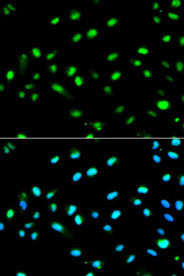 Immunocytochemistry/ Immunofluorescence - Anti-LETMD1/HCCR-1 antibody (AB175410)