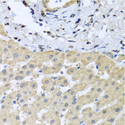 Immunohistochemistry (Formalin/PFA-fixed paraffin-embedded sections) - Anti-LETMD1/HCCR-1 antibody (AB175410)
