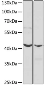 Western blot - Anti-LETMD1/HCCR-1 antibody (AB175410)