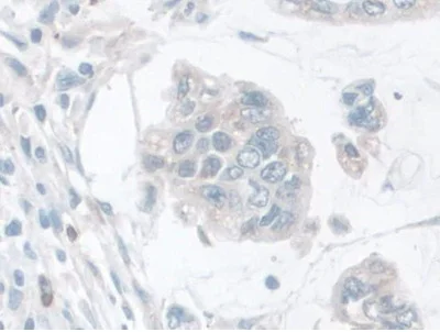 Immunohistochemistry (Formalin/PFA-fixed paraffin-embedded sections) - Anti-LETMD1/HCCR-1 antibody (AB233445)
