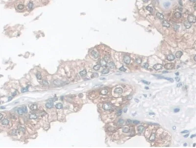 Immunohistochemistry (Formalin/PFA-fixed paraffin-embedded sections) - Anti-LETMD1/HCCR-1 antibody (AB233445)