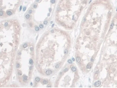 Immunohistochemistry (Formalin/PFA-fixed paraffin-embedded sections) - Anti-LETMD1/HCCR-1 antibody (AB233445)
