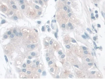 Immunohistochemistry (Formalin/PFA-fixed paraffin-embedded sections) - Anti-LETMD1/HCCR-1 antibody (AB233445)