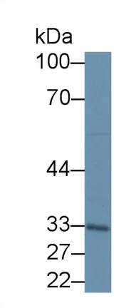 Western blot - Anti-LETMD1/HCCR-1 antibody (AB233445)