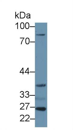 Western blot - Anti-LETMD1/HCCR-1 antibody (AB233445)
