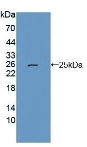 Western blot - Anti-LETMD1/HCCR-1 antibody (AB233445)