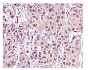 Immunohistochemistry (Formalin/PFA-fixed paraffin-embedded sections) - Anti-Leukotriene A4 hydrolase/LTA4H antibody [EPR5712] (AB109434)