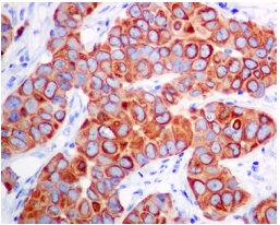 Immunohistochemistry (Formalin/PFA-fixed paraffin-embedded sections) - Anti-Leukotriene B4 Receptor/BLT antibody [EPR7113] - BSA and Azide free (AB248355), expandable thumbnail