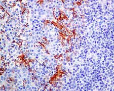 Immunohistochemistry (Formalin/PFA-fixed paraffin-embedded sections) - Anti-Leukotriene B4 Receptor/BLT antibody [EPR7113] - BSA and Azide free (AB248355)