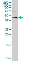 Western blot - Anti-Leupaxin antibody (AB67571)