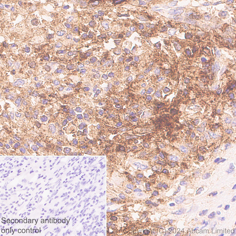 Immunohistochemistry (Formalin/PFA-fixed paraffin-embedded sections) - Anti-Lewis a,b carbohydrate antibody [HEA164] (AB322960), expandable thumbnail