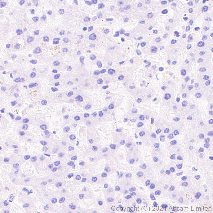 Immunohistochemistry (Formalin/PFA-fixed paraffin-embedded sections) - Anti-Lewis a,b carbohydrate antibody [HEA164] (AB322960), expandable thumbnail