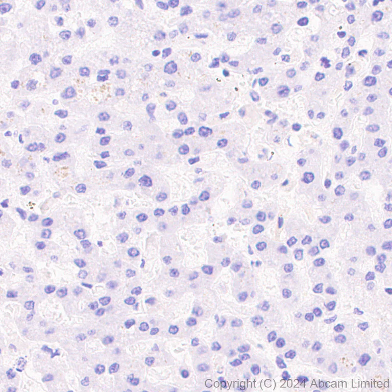 Immunohistochemistry (Formalin/PFA-fixed paraffin-embedded sections) - Anti-Lewis a,b carbohydrate antibody [HEA164] (AB322960)