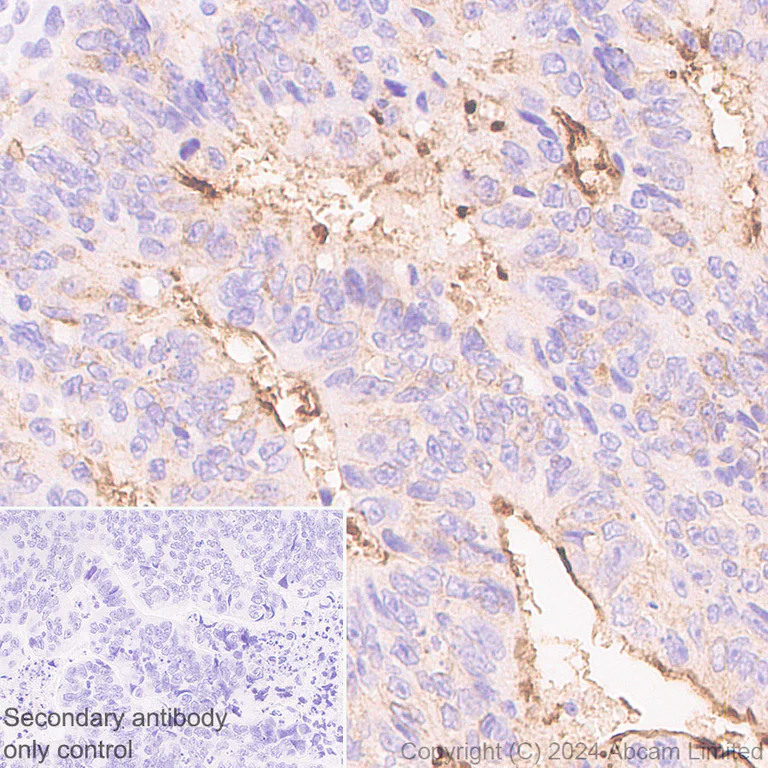 Immunohistochemistry (Formalin/PFA-fixed paraffin-embedded sections) - Anti-Lewis a,b carbohydrate antibody [HEA164] - BSA and Azide free (AB324810)