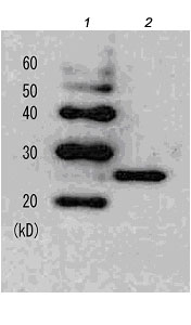 Western blot - Anti-LexA DNA Binding Region antibody (AB174384)