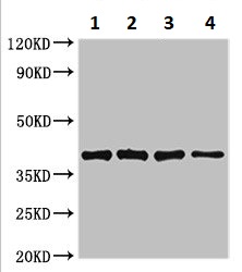 Western blot - Anti-LexA DNA Binding Region antibody (AB234695), expandable thumbnail