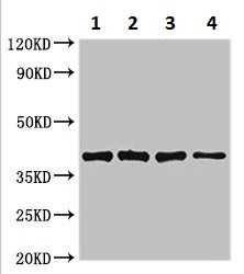 Western blot - Anti-LexA DNA Binding Region antibody (AB234695)