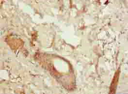 Immunohistochemistry (Formalin/PFA-fixed paraffin-embedded sections) - Anti-LGALS12 antibody (AB235039)