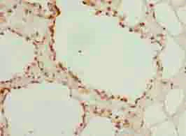 Immunohistochemistry (Formalin/PFA-fixed paraffin-embedded sections) - Anti-LGALS12 antibody (AB235039)